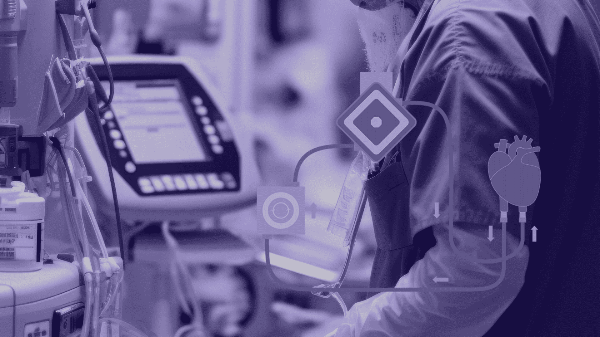 ECMO для анестезіолога: алгоритми, ризики, рішення